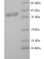 Mouse Erythroferrone (Erfe) Recombinant Protein - BioCrest Sci
