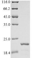 Rat Beta-synuclein (Sncb) Recombinant Protein - BioCrest Sci
