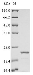 Rat Beta-synuclein (Sncb) Recombinant Protein, Rattus norvegicus (Rat), E.coli, N-terminal 10xHis-tagged, 20.5 kDa, purity >≥ 85% as determined by SDS-PAGE.