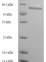 Human FAD synthase (FLAD1) Recombinant Protein - BioCrest Sci