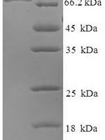 Mouse BAG family molecular chaperone regulator 3 (Bag3) Recombinant Protein, N-His-SUMO - BioCrest Sci