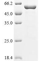 Human V-type proton ATPase subunit B,brain isoform (ATP6V1B2) Recombinant Protein, N-10His/C-Myc - BioCrest Sci