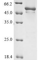 Venezuelan equine encephalitis virus Polyprotein P1234, partial Recombinant Protein, N-His - BioCrest Sci