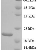 Human Urokinase-type plasminogen activator (PLAU), partial Recombinant Protein, N-His - BioCrest Sci