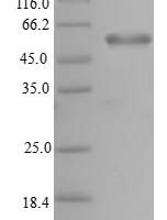 Human PHD finger protein 11 (PHF11) Recombinant Protein - BioCrest Sci