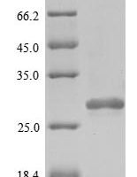 Human Peroxiredoxin-2 (PRDX2) Recombinant Protein, N-10His - BioCrest Sci