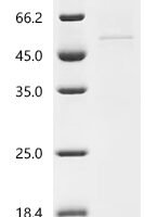 Human E3 ubiquitin-protein ligase TRIM11 (TRIM11) Recombinant Protein, C-His - BioCrest Sci