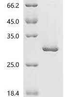 Mouse Ras-related C3 botulinum toxin substrate 2 (Rac2) Recombinant Protein - BioCrest Sci