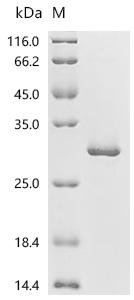 Mouse Ras-related C3 botulinum toxin substrate 2 (Rac2) Recombinant Protein, Mus musculus (Mouse), E.coli, C-terminal 6xHis-tagged, 28.0 kDa, purity >≥ 90% as determined by SDS-PAGE.