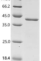 Human Serine/threonine-protein phosphatase 6 catalytic subunit (PPP6C) Recombinant Protein - BioCrest Sci