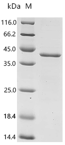 Human Serine/threonine-protein phosphatase 6 catalytic subunit (PPP6C) Recombinant Protein, Homo sapiens (Human), E.coli, C-terminal 6xHis-tagged, 41.9 kDa, purity >≥ 85% as determined by SDS-PAGE.