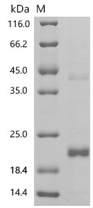 Human Growth/differentiation factor 11 (GDF11) Recombinant Protein, Homo sapiens (Human), E.coli, C-terminal 6xHis-tagged, 19.4 kDa, purity >≥ 90% as determined by SDS-PAGE.