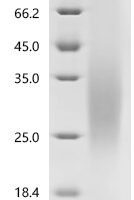 Human Neutral amino acid transporter 9 (SLC38A9),partial Recombinant Protein, C-His, aa 1–119, Yeast - BioCrest Sci