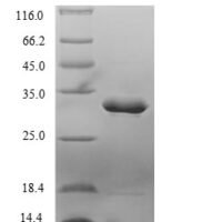 Tachypleus tridentatus clotting factor C, partial Recombinant Protein, N-10His/C-Myc - BioCrest Sci