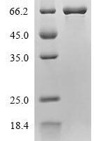 Human Delta-1-pyrroline-5-carboxylate dehydrogenase, mitochondrial (ALDH4A1) Recombinant Protein - BioCrest Sci