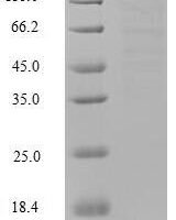 Human Guanylate cyclase activator 2B (GUCA2B) Recombinant Protein, N-His, aa 27–112, Mammalian cell - BioCrest Sci