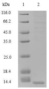 Human Guanylate cyclase activator 2B (GUCA2B) Recombinant Protein, N-His, aa 27–112, Mammalian cell, Homo sapiens (Human), Mammalian cell, N-terminal 6xHis-tagged, 13.5 kDa, purity >≥ 90% as determined by SDS-PAGE.
