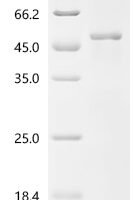 Newcastle disease virus Fusion glycoprotein F0 (F), partial Recombinant Protein, N-10His/C-Myc, aa 32–500, strain Her/33 - BioCrest Sci