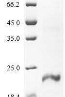 Human Inhibin beta E chain (INHBE) Recombinant Protein, C-His - BioCrest Sci
