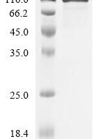 Human Glypican-3 (GPC3), partial Recombinant Protein - BioCrest Sci