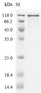 Human Glypican-3 (GPC3), partial Recombinant Protein, Homo sapiens (Human), Mammalian cell, C-terminal 10xHis-HSA-tagged, 107.4 kDa, purity >≥ 90% as determined by SDS-PAGE.