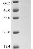 Streptococcus pneumoniae serotype 4 Pneumolysin (ply),Biotinylated Recombinant Protein - BioCrest Sci