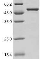 Human Serine/threonine-protein kinase B-raf  (BRAF)(V600E), partial Recombinant Protein - BioCrest Sci