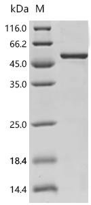 Human Serine/threonine-protein kinase B-raf (BRAF)(V600E), partial Recombinant Protein, Homo sapiens (Human), E.coli, C-terminal 11xHis-tagged, 49.6 kDa, purity >≥ 85% as determined by SDS-PAGE.