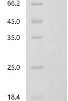 Bovine pro-epidermal growth factor (EGF), partial Recombinant Protein, C-His, aa 990–1046 - BioCrest Sci