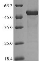 Human 2-Hydroxyacid oxidase 2 (HAO2) Recombinant Protein - BioCrest Sci