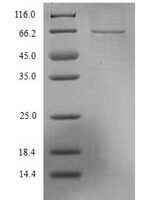 Lassa virus Nucleoprotein (N) Recombinant Protein, N-His - BioCrest Sci