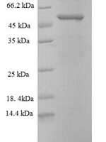 Human Disintegrin and metalloproteinase domain-containing protein 15 (ADAM15), partial Recombinant Protein - BioCrest Sci