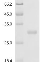 Mouse Prolactin (Prl) Recombinant Protein, N-His - BioCrest Sci