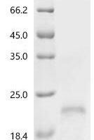 Human Corticotropin-releasing factor receptor 1 (CRHR1 ), partial Recombinant Protein - BioCrest Sci