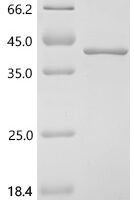 Mouse Fos-related antigen 1 (Fosl1) Recombinant Protein, N-10His - BioCrest Sci