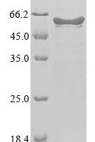 Human coronavirus OC43 Nucleoprotein (N) Recombinant Protein, N-His - BioCrest Sci