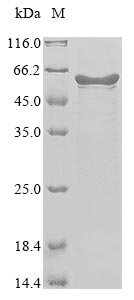 Human coronavirus OC43 Nucleoprotein (N) Recombinant Protein, N-His, Human coronavirus OC43 (HCoV-OC43), E.coli, N-terminal 6xHis-tagged, 55.3 kDa, purity >≥ 85% as determined by SDS-PAGE.