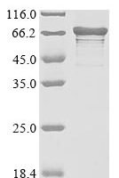 Human La-related protein 6 (LARP6) Recombinant Protein, N-10His/C-Myc - BioCrest Sci