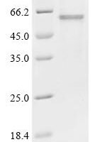 Human Actin, alpha skeletal muscle(ACTA1) Recombinant Protein - BioCrest Sci