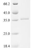 Human Cathepsin G (CTSG) Recombinant Protein, C-His, aa 21–255, E.coli - BioCrest Sci