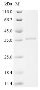 Human Cathepsin G (CTSG) Recombinant Protein, C-His, aa 21–255, E.coli, Homo sapiens (Human), E.coli, C-terminal 6xHis-tagged, 33.7 kDa, purity >≥ 95% as determined by SDS-PAGE.