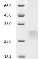 Human Folate receptor alpha (FOLR1), partial Recombinant Protein - BioCrest Sci