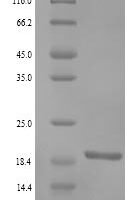 Human RING finger protein 11 (RNF11) Recombinant Protein, N-His - BioCrest Sci