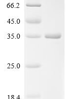 Mouse CD209 antigen-like protein B (Cd209b), partial Recombinant Protein - BioCrest Sci