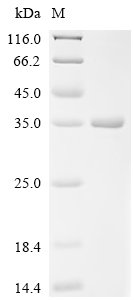 Mouse CD209 antigen-like protein B (Cd209b), partial Recombinant Protein, Mus musculus (Mouse), E.coli, N-terminal 10xHis-tagged, 35.3 kDa, purity >≥ 95% as determined by SDS-PAGE.