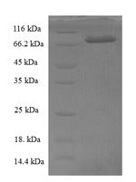 Cucurbita maxima L-ascorbate oxidase (AAO) Recombinant Protein - BioCrest Sci