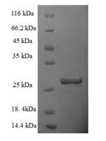 Human Mitochondrial import inner membrane translocase subunit Tim10 B (TIMM10B) Recombinant Protein - BioCrest Sci