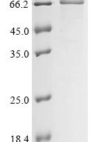 Human Insulin-like growth factor 2 mRNA-binding protein 1 (IGF2BP1) Recombinant Protein - BioCrest Sci