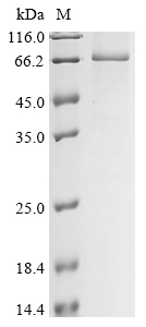 Human Insulin-like growth factor 2 mRNA-binding protein 1 (IGF2BP1) Recombinant Protein, Homo sapiens (Human), Baculovirus, C-terminal 6xHis-tagged, 69.1 kDa, purity >≥ 85% as determined by SDS-PAGE.