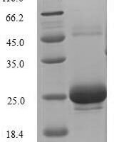 Rat Sclerostin domain-containing protein 1 (Sostdc1) Recombinant Protein, N-10His/C-Myc, aa 24–206, Baculovirus - BioCrest Sci